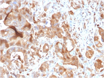 FABP5 Antibody (epidermal)