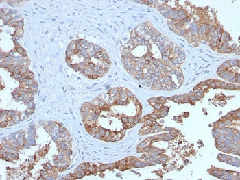 MUC1 Antibody / Mucin-1