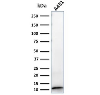 S100A2 Antibody