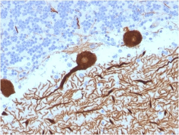 CA8 Antibody / Carbonic Anhydrase VIII