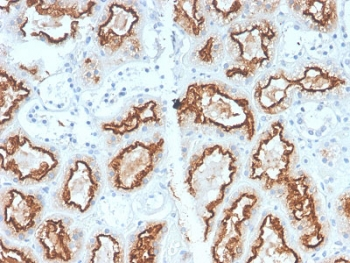 CA9 Antibody / Carbonic Anhydrase IX