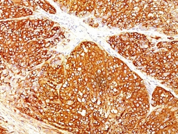 Melanoma Cell Marker Antibody Cocktail (anti-MART-1 + gp100 + Tyrosinase)
