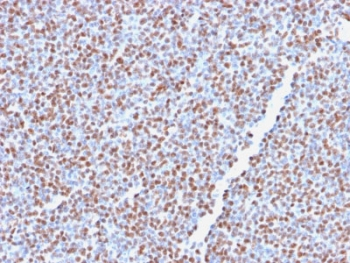 ALK Antibody / Anaplastic Lymphoma Kinase