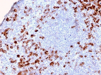 Kappa Light Chain Antibody