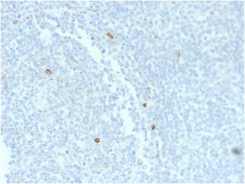 IgM Heavy Chain Antibody