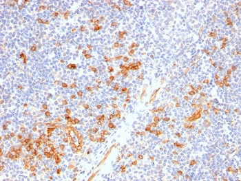 IL3RA Antibody / CD123