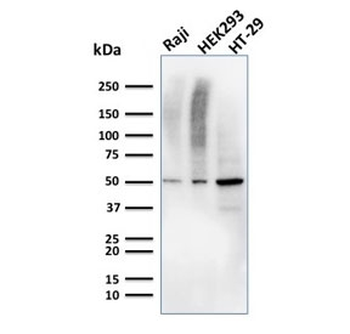 MMP3 Antibody / Matrix Metalloproteinase 3