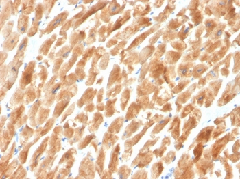 Dystrophin Antibody / DMD