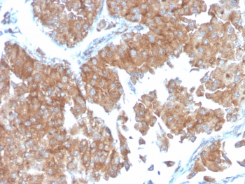 SERBP1 Antibody / PAI-RBP1