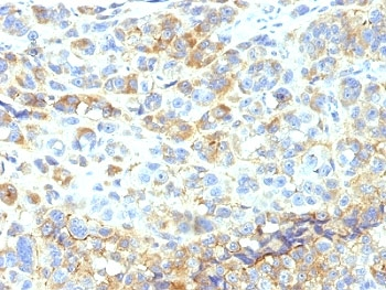 ICAM1 Antibody / CD54
