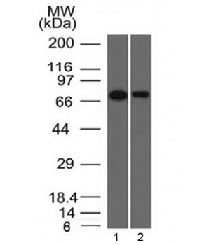 CD105 Antibody / Endoglin