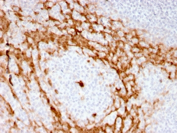 CSF3 Antibody / Granulocyte-Colony Stimulating Factor