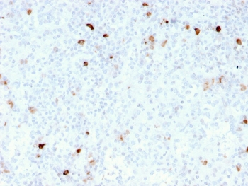 IgM Heavy Chain Antibody