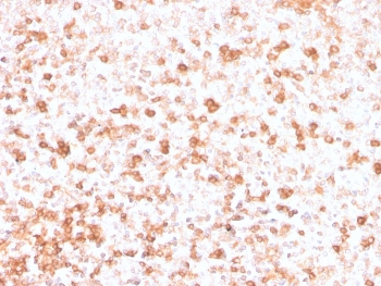 Lambda Light Chain Antibody / Lambda Antibody