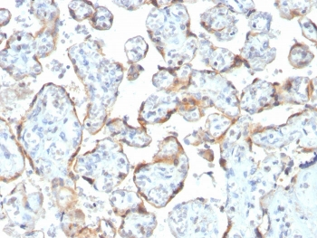 TIMP2 Antibody