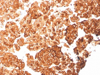 Cytokeratin 6A Antibody