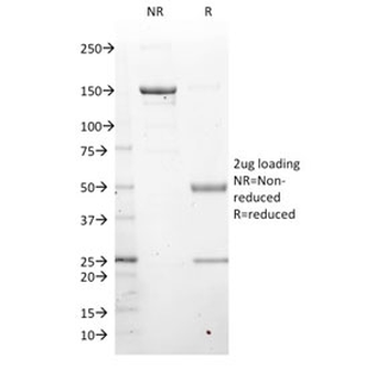 LMO2 Antibody / Rhombotin 2