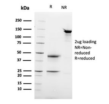 Desmoglein 3 Antibody / DSG3