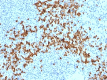 MMP9 Antibody / Matrix metalloproteinase-9