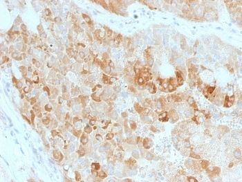 ROR2 Antibody