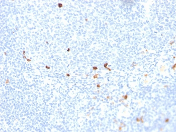 IgM Heavy Chain Antibody