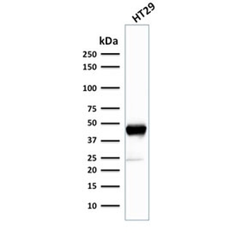 Cytokeratin 20 Antibody / CK20