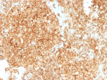 CD45 Antibody Cocktail (Leukocyte marker)