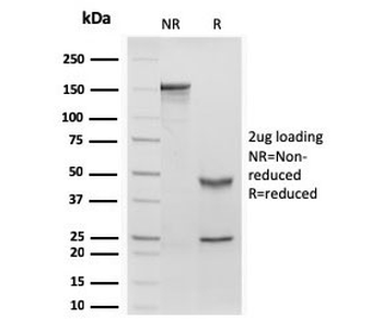 RBP Antibody / Retinol Binding Protein 1