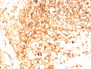 IgM Heavy Chain Antibody