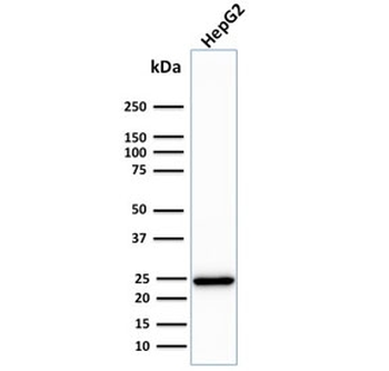C1QA Antibody / Complement C1q A-Chain