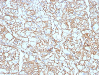 PD-L1 Antibody / B7-H1 / CD274