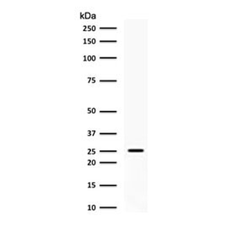 C1QA Antibody / Complement C1q A-Chain