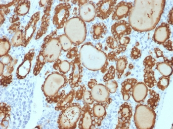 Thyroid Peroxidase Antibody