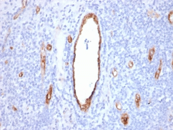 von Willebrand Factor Antibody / vWF