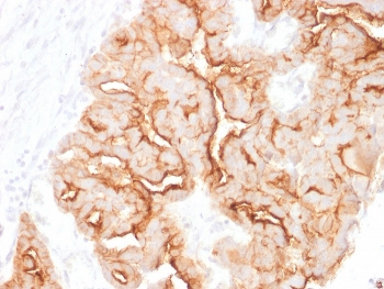 MUC16 Antibody / CA125