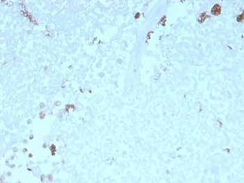 ATG5 Antibody