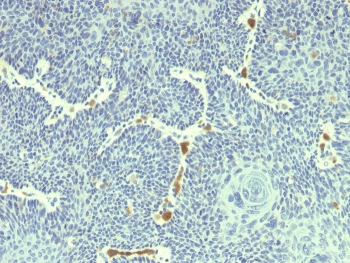 HPV18 E6 Antibody