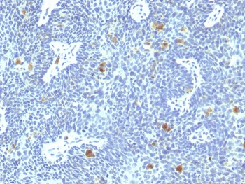 HPV-16 E6 Antibody