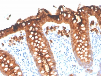 CEA Antibody / Carcinoembryonic Antigen