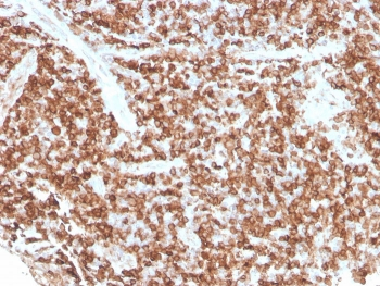 CD74 / CLIP Antibody
