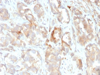 Keratin 6B Antibody / Cytokeratin 6B