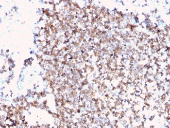 CD45 Antibody (Leukocyte marker)