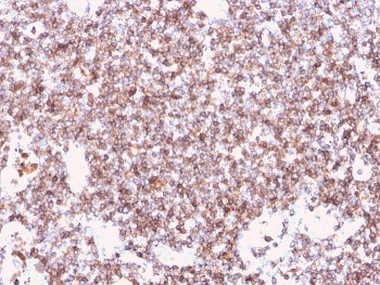 CD45 Antibody (Leukocyte marker)