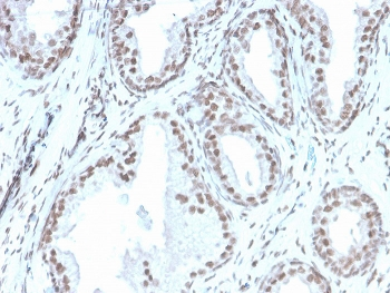 ATRX Antibody / RAD54