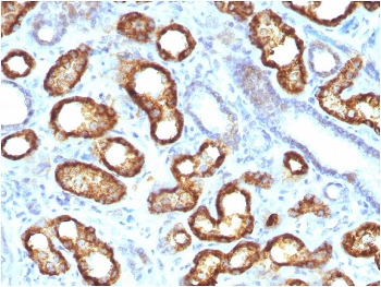 AMACR / p504S Antibody (Prostate Cancer Marker)