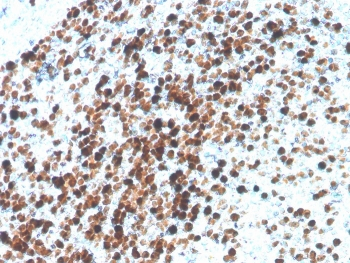 Topoisomerase II alpha Antibody / TOP2A