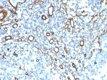 Collagen IV Antibody / COL4A