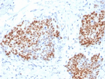 SOX9 Antibody / SRY-box 9