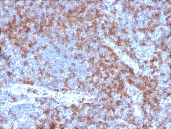 CD22 Antibody / BL-CAM