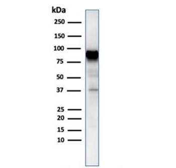 HSP90 beta Antibody / HSP90AB1